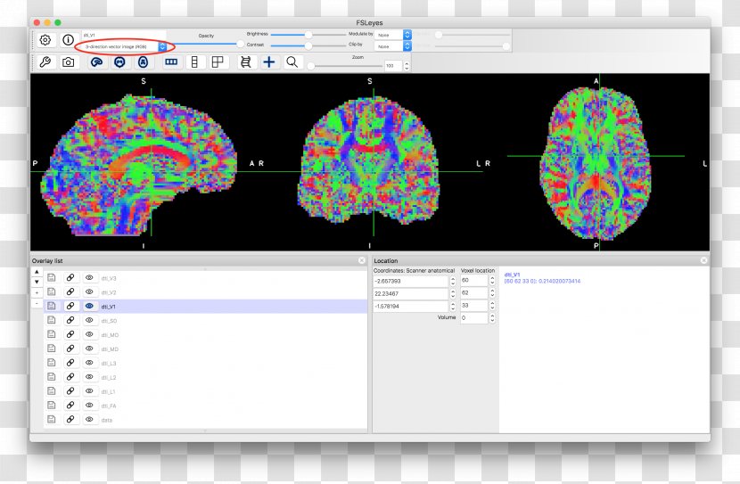 Diffusion MRI Scalar Tensor Corticospinal Tract - Quantity Transparent PNG