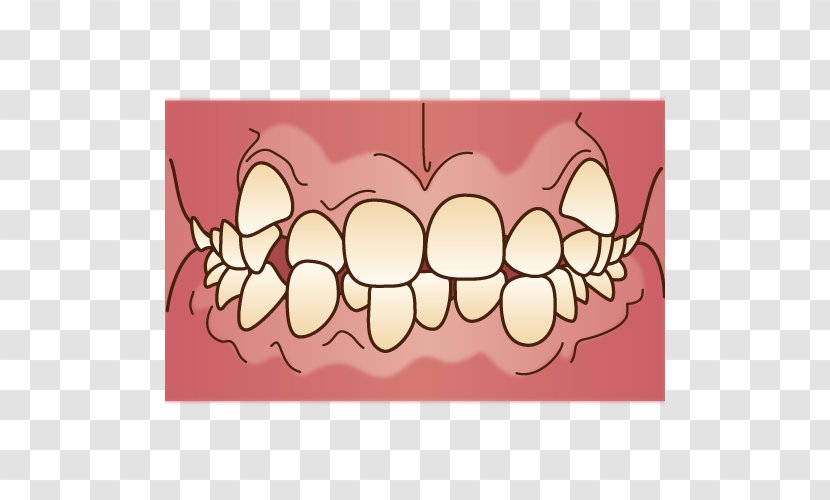 Dental Braces 矯正歯科 Dentist Mouthguard - Frame - Orthodontics Transparent PNG