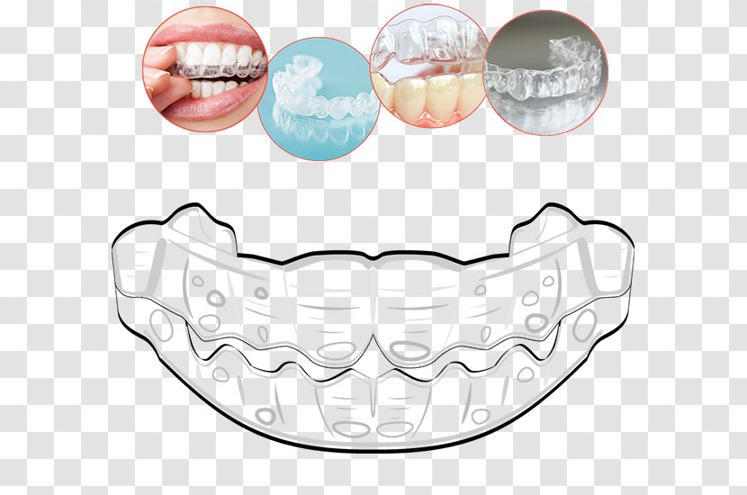 Tooth Clear Aligners Orthodontics Therapy Mouth - Heart - Invisalign Transparent PNG