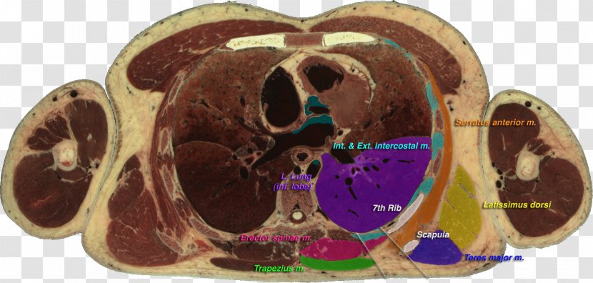 Visible Human Project Triangle Of Auscultation Foundational Model Anatomy Thoracic Vertebrae - Frame - Heart Transparent PNG