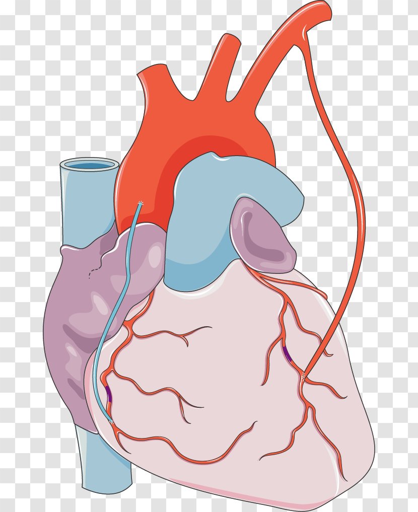 Myocardial Infarction Heart Coronary Artery Disease Blood - Frame - The Anatomy Of A Body Medicine Transparent PNG