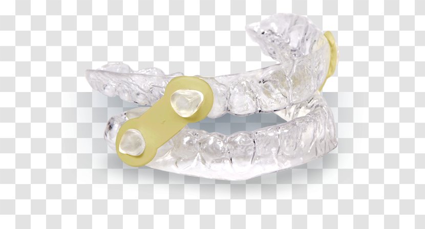 Mandibular Advancement Splint Sleep Apnea White Smile Dental Snoring - Jewellery - Both Side Flyer Transparent PNG