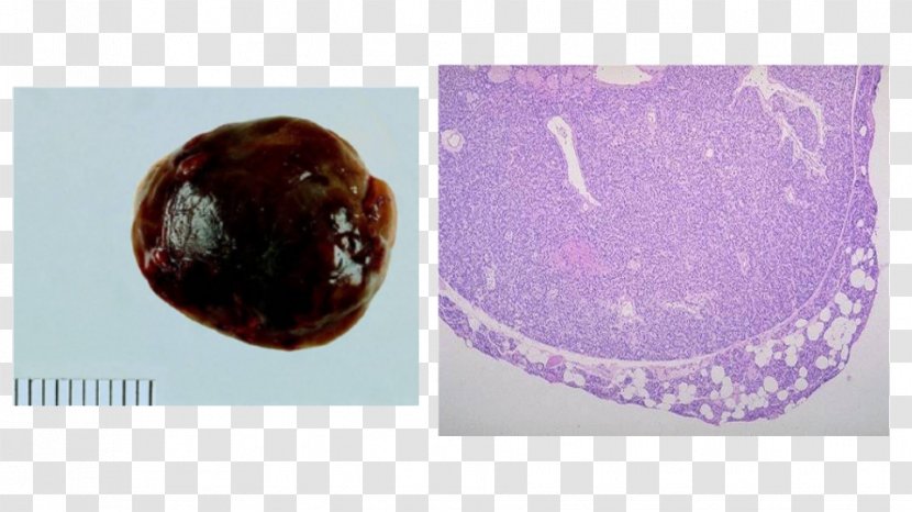 Cell Neoplasm Organism Epithelium Video - Purple - Pituitary Gland Transparent PNG