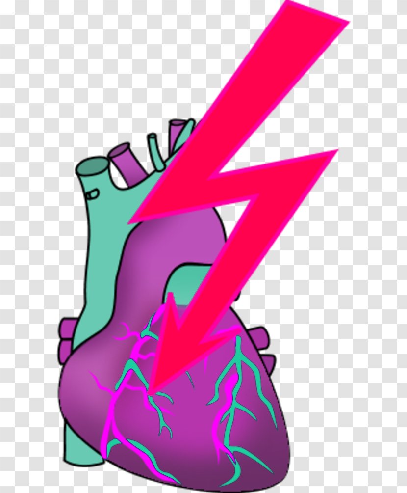 Heart Myocardial Infarction Clip Art - Footwear - Attack Transparent PNG