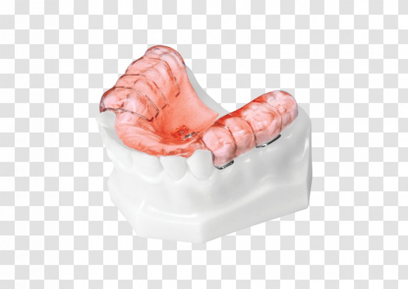 Tooth Orthodontics Home Appliance Orthodontic Technology Product Design - Canine - Correction Transparent PNG