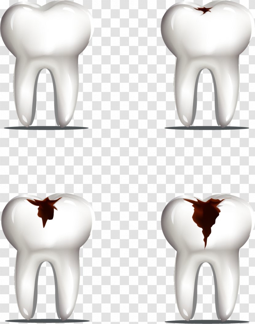 Tooth Decay Molar - Tree - Vector Painted Transparent PNG