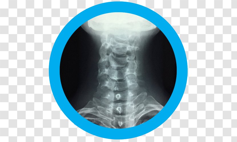 Computed Tomography Radiology Medical Radiography X-ray - Service - Prevention Of Migraines Transparent PNG