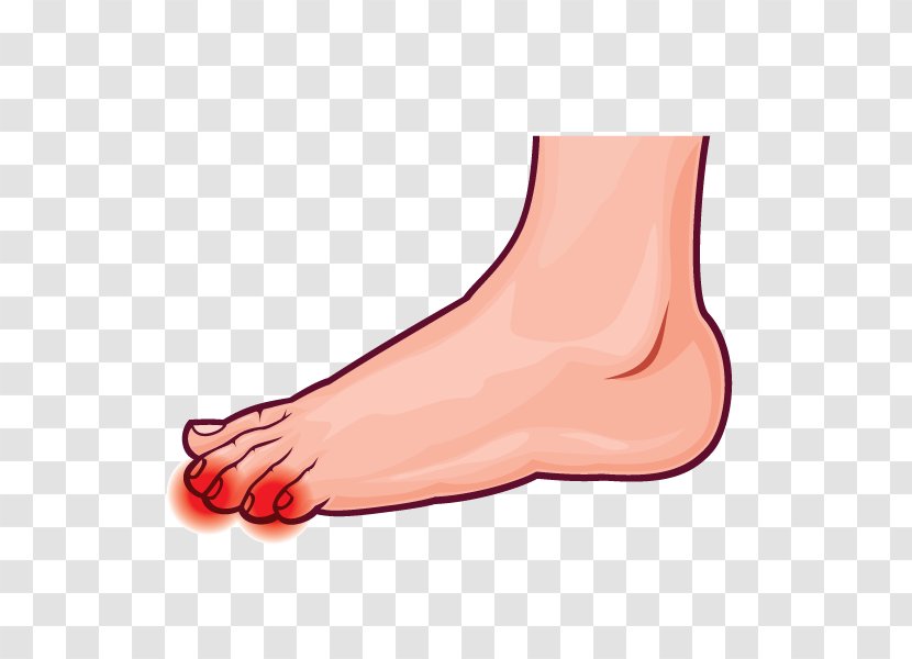 Thumb Toe Ankle Pronation Of The Foot - Watercolor - Ball Transparent PNG