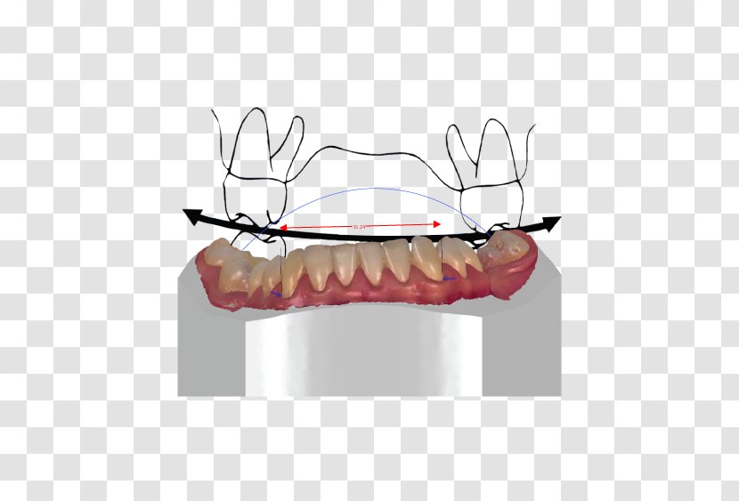 Orthodontics Tooth CAD/CAM Dentistry Orthodontic Technology - Tree - Right Key Transparent PNG