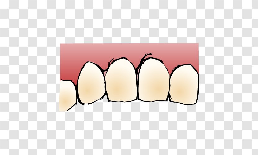 Tooth いがらし歯科クリニック Dentist Dental Implant - Dentistry Transparent PNG