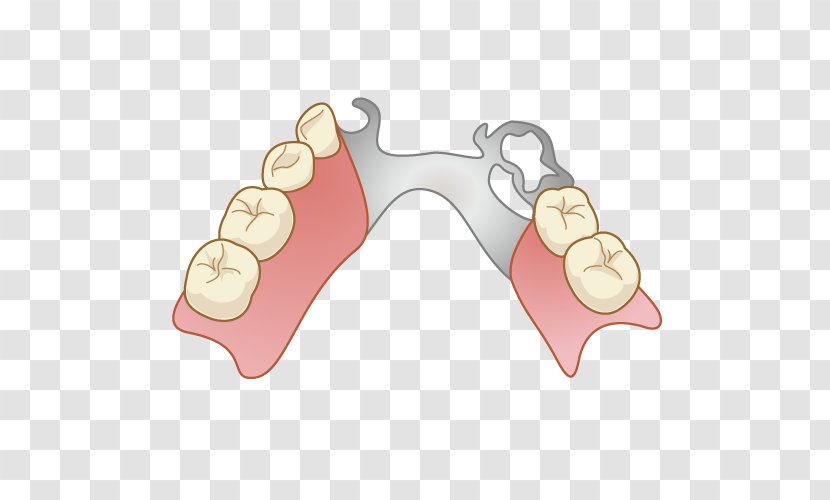Dentures Dentist Removable Partial Denture Dental Technician Tooth Decay - Therapy Transparent PNG