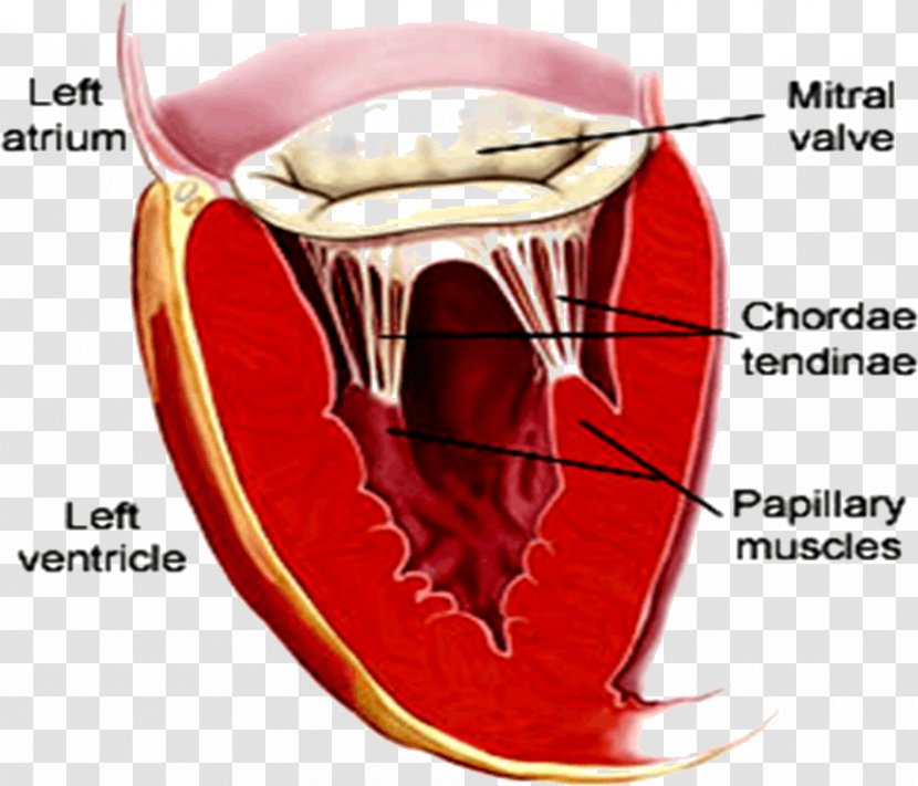 Mitral Valve Stenosis Heart Insufficiency - Cartoon Transparent PNG