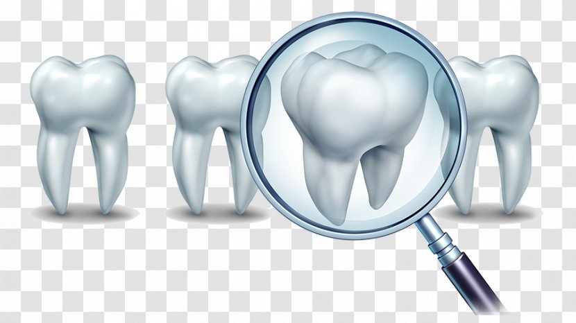 Cosmetic Dentistry Dental Implant Human Tooth - Frame Transparent PNG
