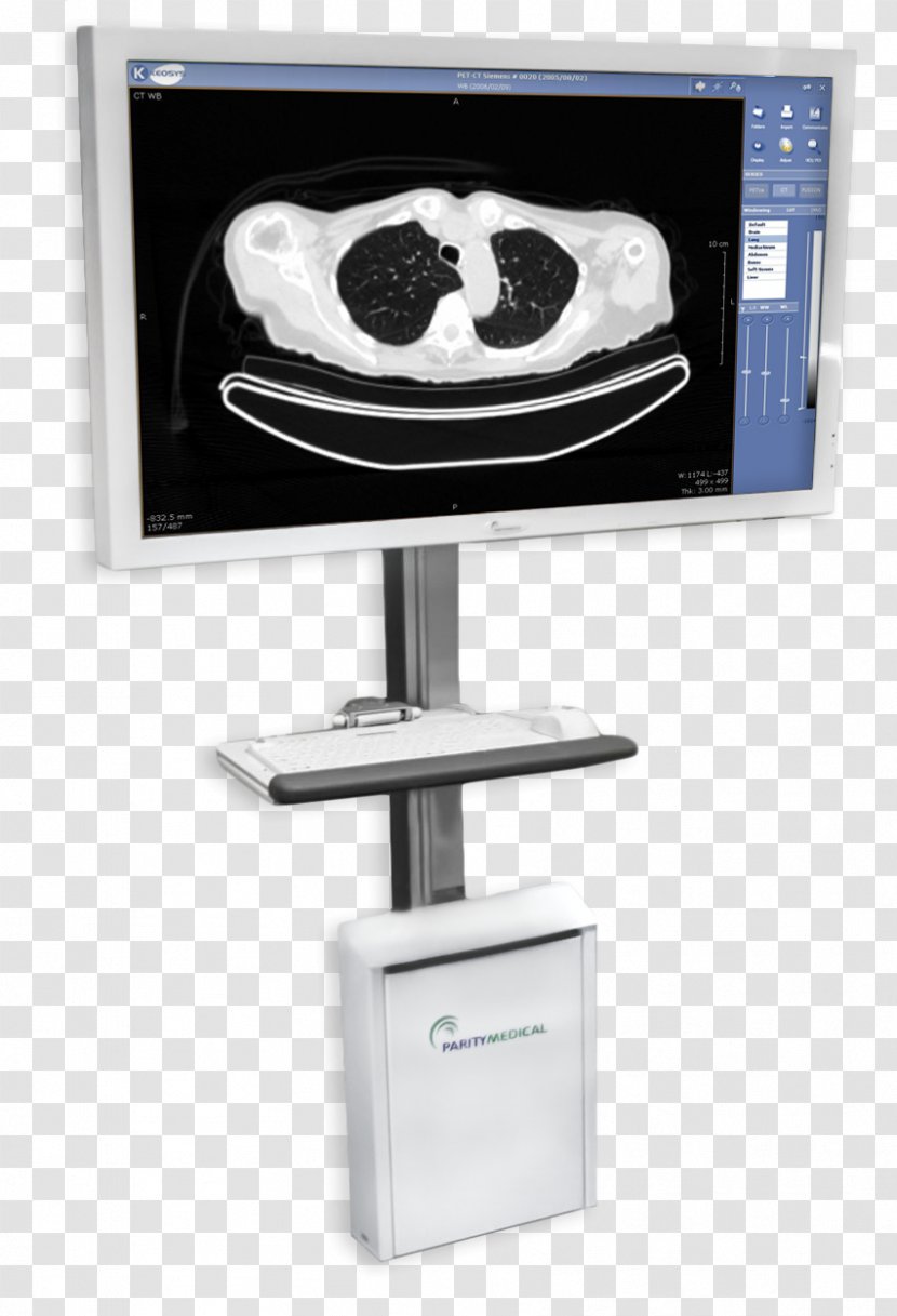 Medicine Picture Archiving And Communication System Radiology Display Device McKesson Corporation - Computer Transparent PNG