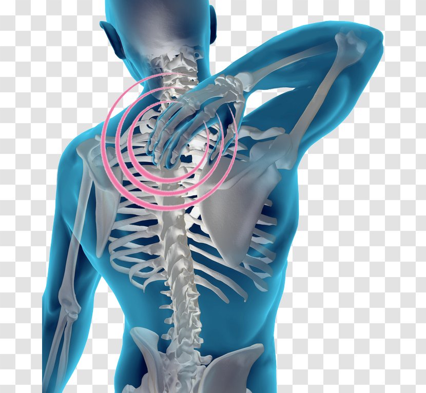 Pain In Spine Vertebral Column Human Back Cervical Vertebrae Facet Joint - Tree - Chir Transparent PNG