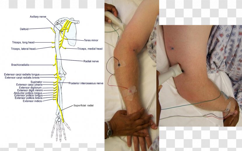 Thumb Radial Nerve Axillary Muscle - Watercolor - Flower Transparent PNG