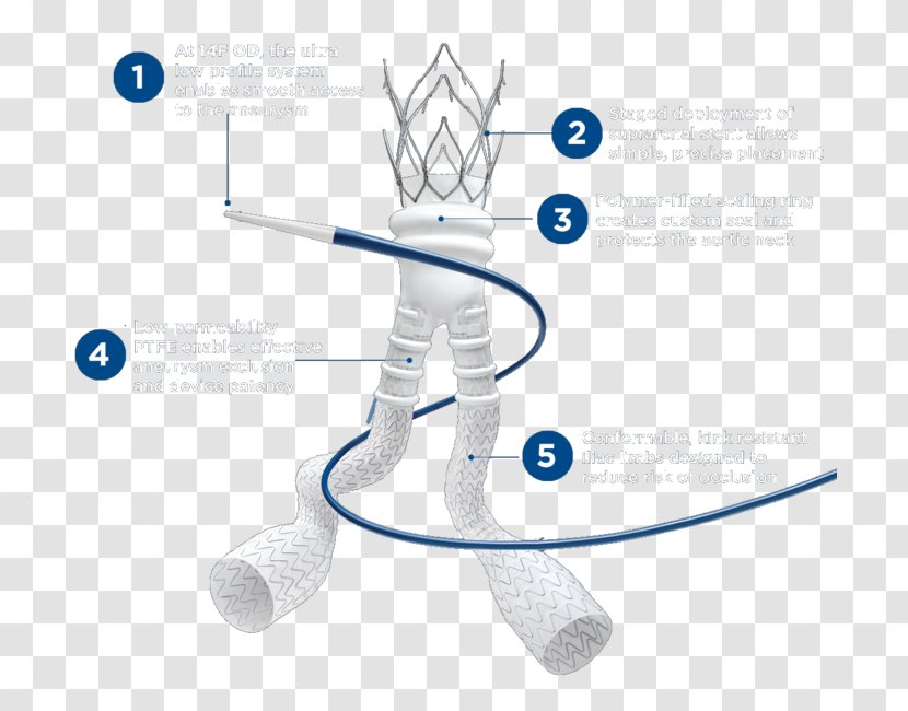 Aneurysm Abdominal Aorta Abdomen Market - Endologix Inc Transparent PNG