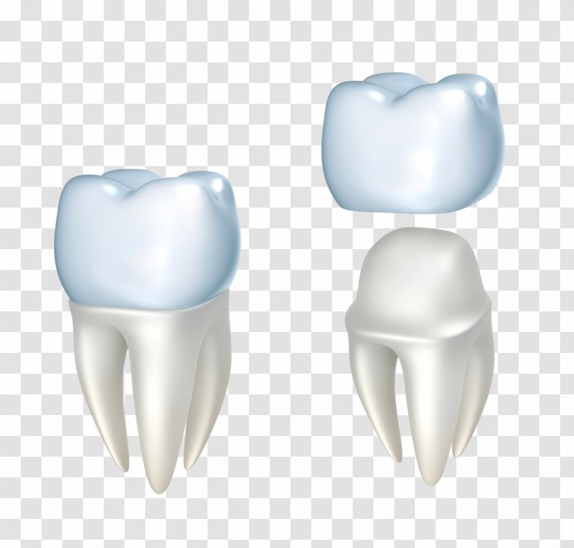Crown Dentistry Dental Restoration Bridge - Frame - Floss Transparent PNG