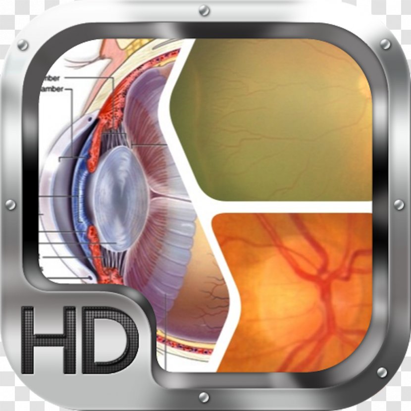 Human Eye Cataract Visual System Sense - Agy Transparent PNG