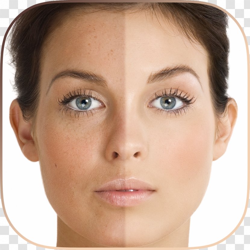 Hyperpigmentation Skin Care Liver Spot Pimple - Eyebrow - Aging Transparent PNG