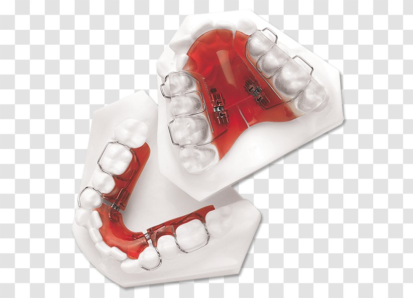 Sagittal Plane Coronal Finger Distal Occlusion - Palatal Expansion Transparent PNG