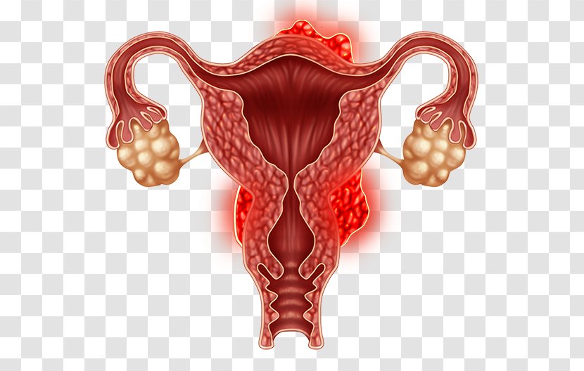 Ovary Uterine Fibroid Laparoscopy Uterus Gynaecology - Frame - Health Transparent PNG