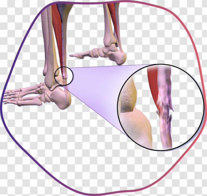 Achilles Tendon Rupture Tendinitis - Watercolor - Torn Hamstring Symptoms Transparent PNG