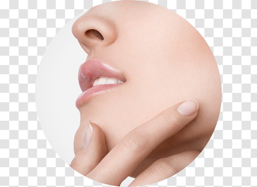 Melasma Forehead Cream Cheek Mouth - Therapy - Nonsurgical Rhinoplasty Transparent PNG