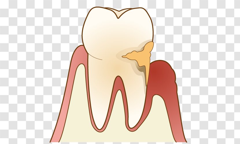 Periodontal Disease Gums 歯科 Dentist Dental Plaque - Flower - Toothbrush Transparent PNG