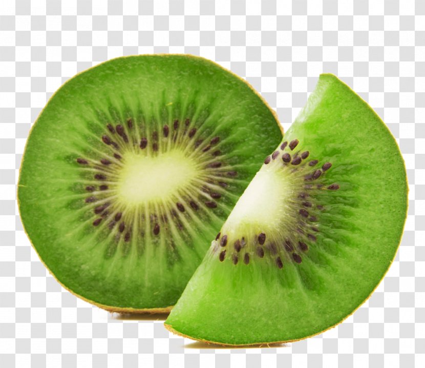 Fruit Salad Kiwifruit Juice Vesicles - Actinidia Deliciosa - Kiwi Transparent PNG