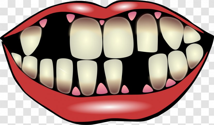 Tooth Pathology Dentistry Clip Art - Flower - Moini Transparent PNG