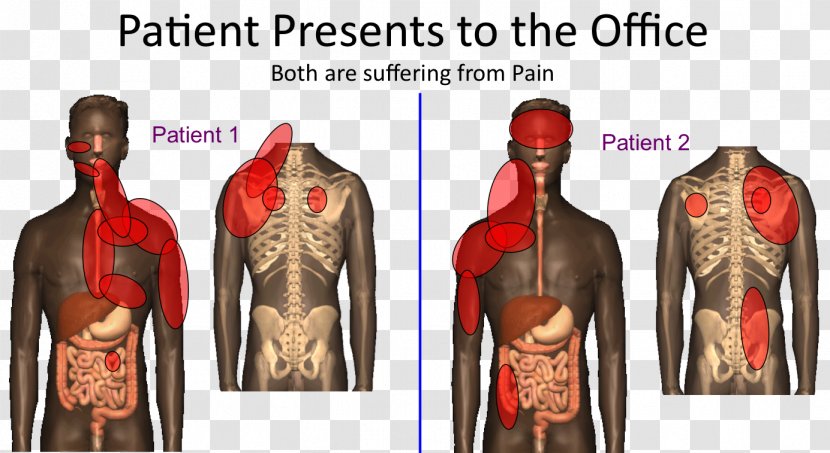 Referred Pain Shoulder Problem Liver Muscle - Cartoon - Somatic Transparent PNG