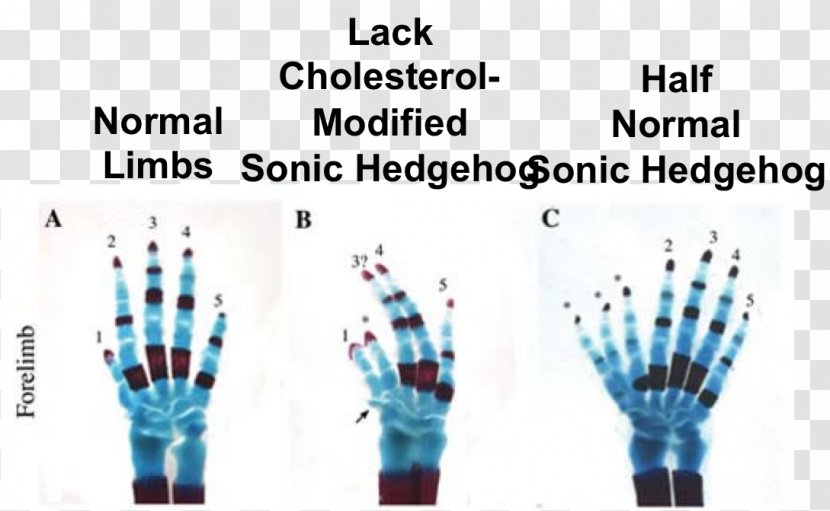 Sonic Hedgehog GLI3 Mouse Signaling Pathway Polydactyly - Tree Transparent PNG