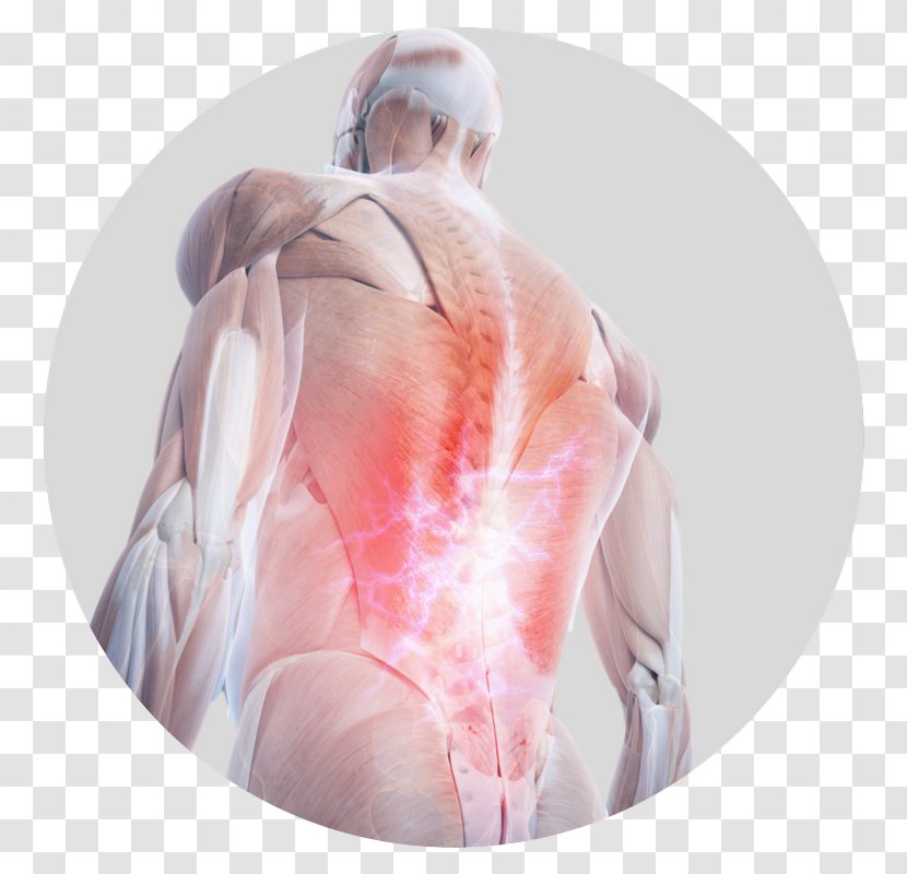 Pain In Spine Human Back Anatomy Body - Watercolor Transparent PNG