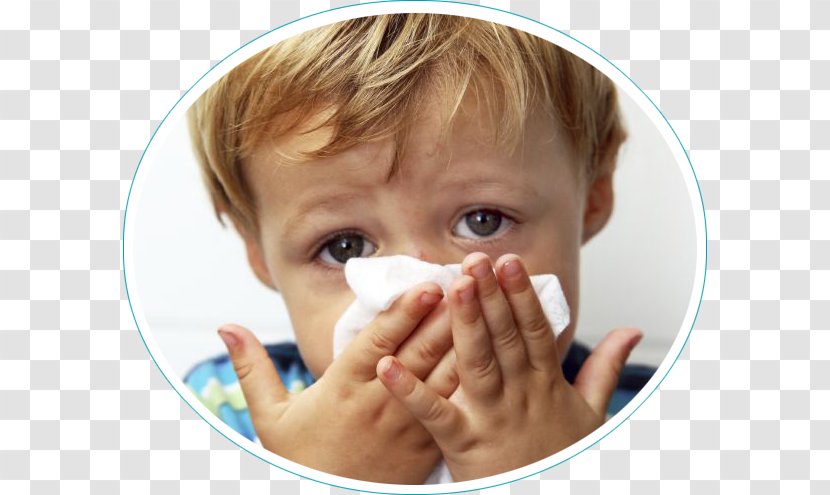 Rhinitis Hay Fever Allergy Child Rhinorrhea - Influenza - Dental Hygienist Transparent PNG