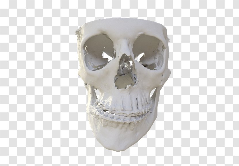 Skull MedCAD Surgery Skeleton Patient - 3d Computer Graphics Transparent PNG