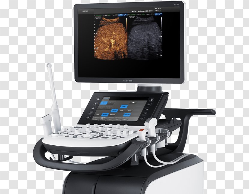 Ultrasonography Ultrasound Samsung Radiology Medicine Transparent PNG