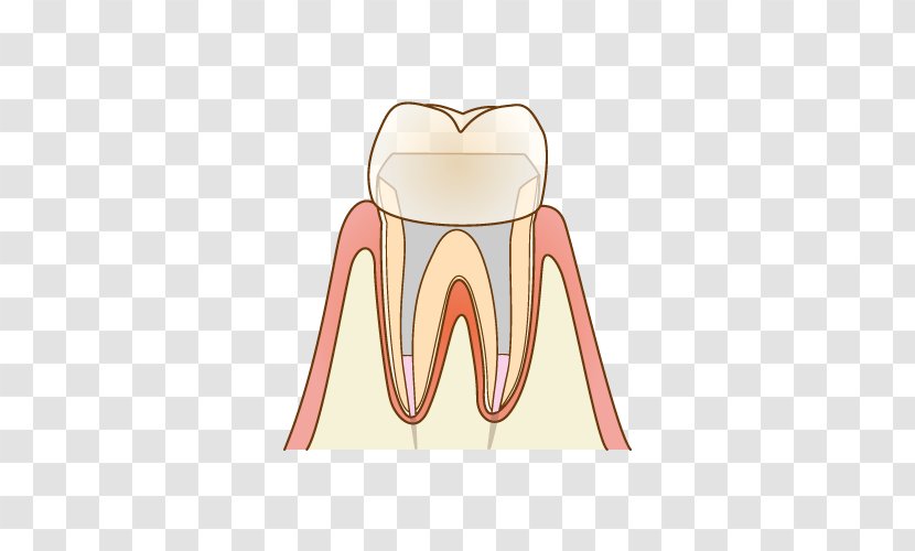 歯科 Dentist Root Canal Therapy Tooth Decay - Silhouette - Endodontic Transparent PNG