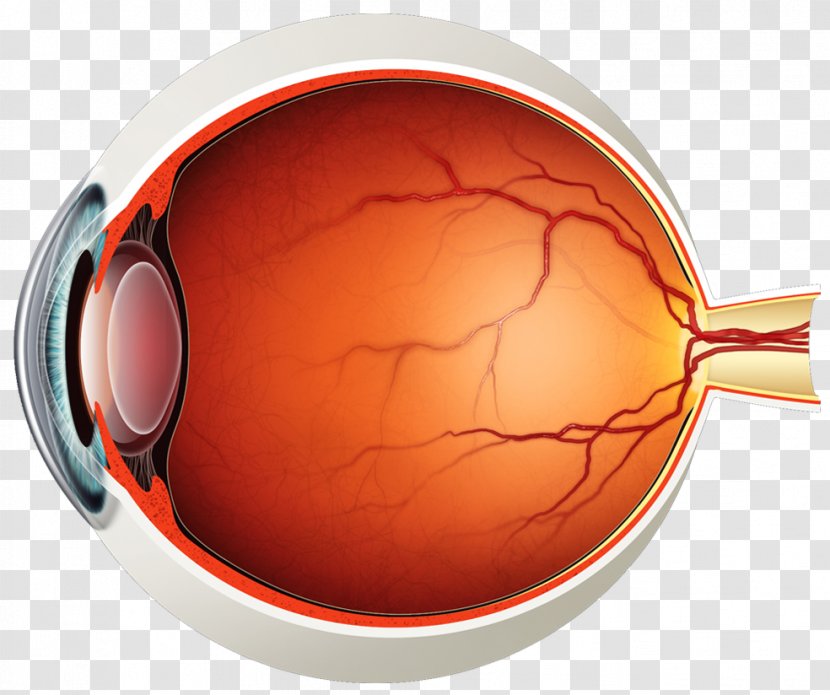 Retinal Detachment Posterior Vitreous Mydriasis Symptom - Macular Degeneration - Eye Transparent PNG