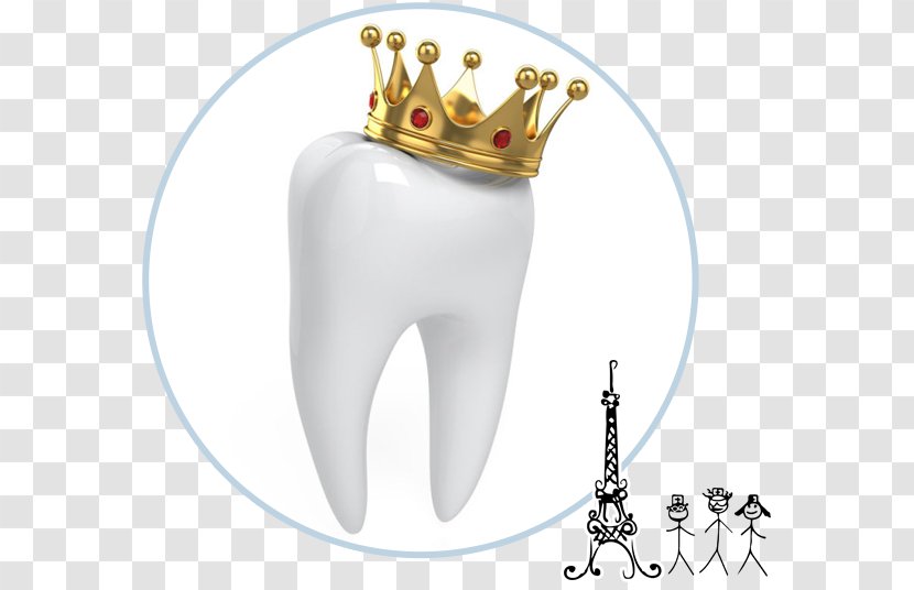 Crown Dentistry Human Tooth - Cartoon Transparent PNG