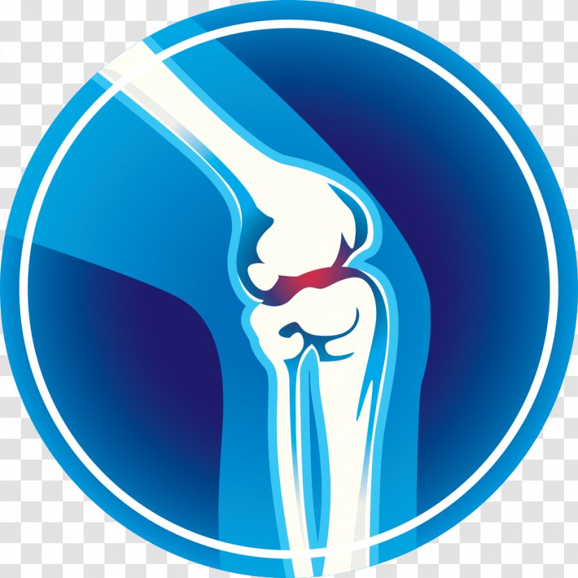 Knee Pain Joint - Cartoon Transparent PNG