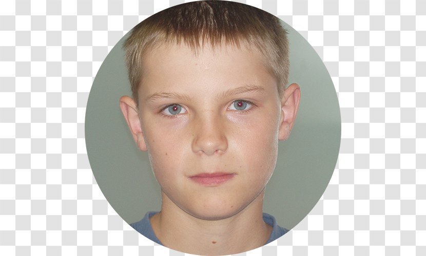 Eyebrow Dyslexia Child Actor Cheek - Boy - Mother-teresa Transparent PNG