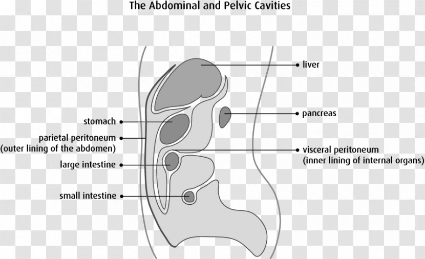 Peritoneum Peritoneal Mesothelioma Cancer Primary Carcinoma Mesothelium - Tree - Cell Details Transparent PNG
