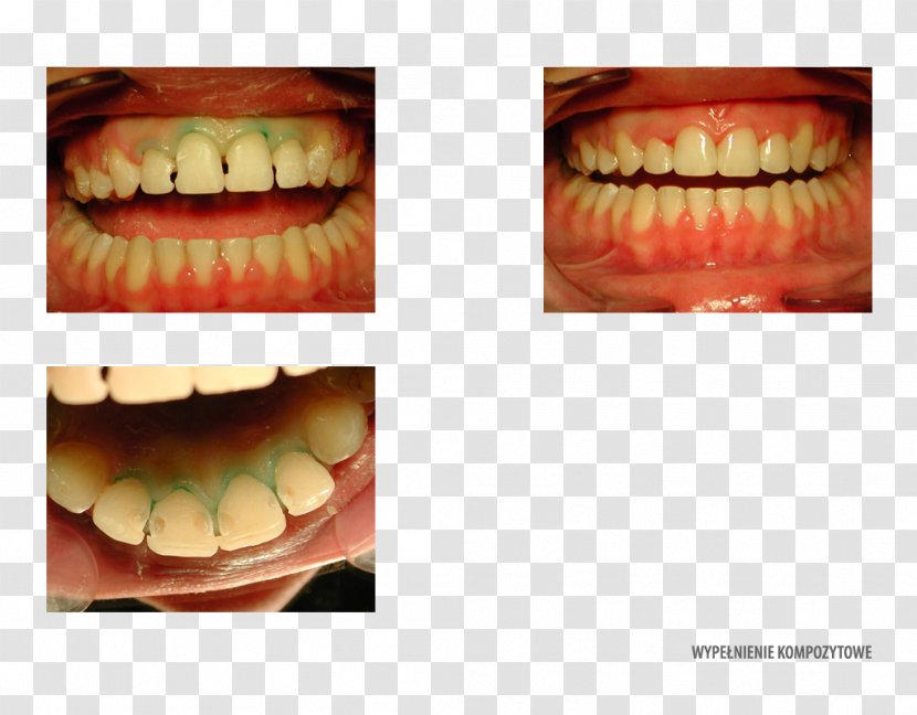 Tooth Decay Dentistry Orthodontics Orange - Service Transparent PNG