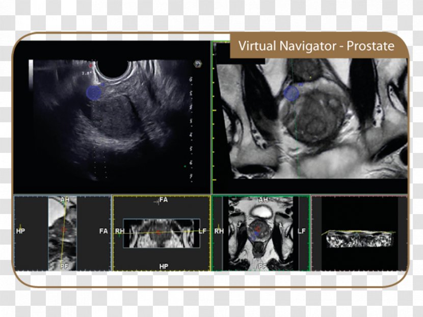 Ultrasonography Magnetic Resonance Imaging Esaote Medical Equipment - Multimedia Polska Transparent PNG