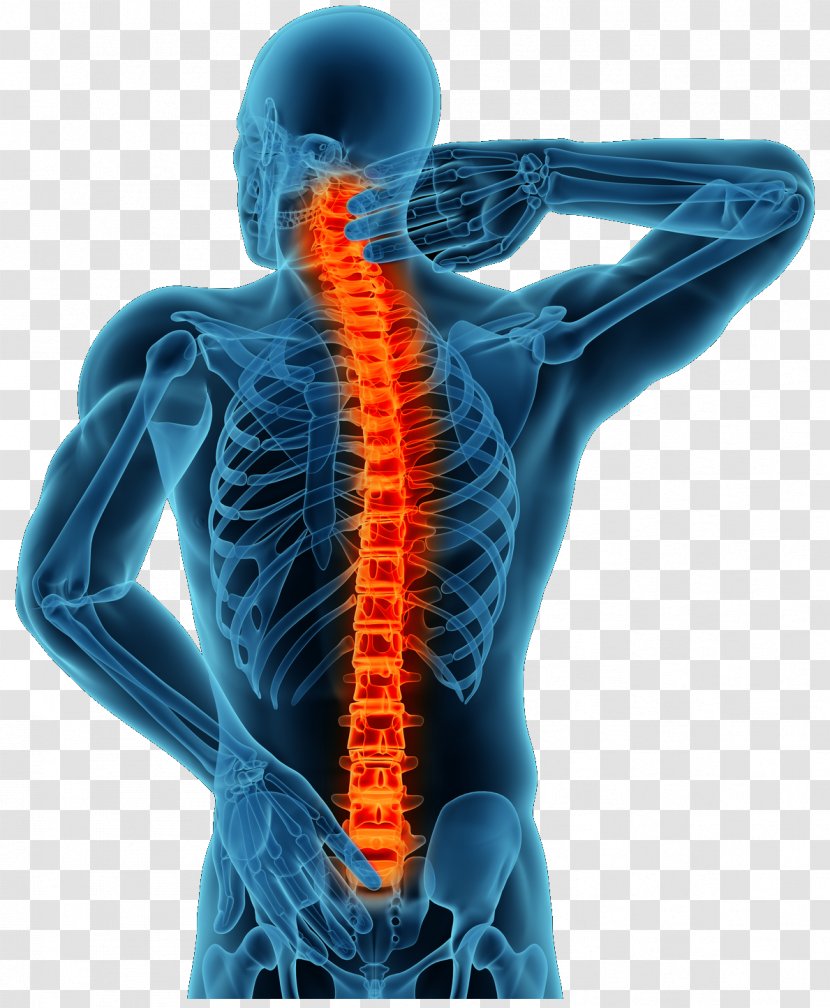 Back Pain Management Therapy Spinal Disc Herniation Degenerative Disease - Neck - Treats Transparent PNG