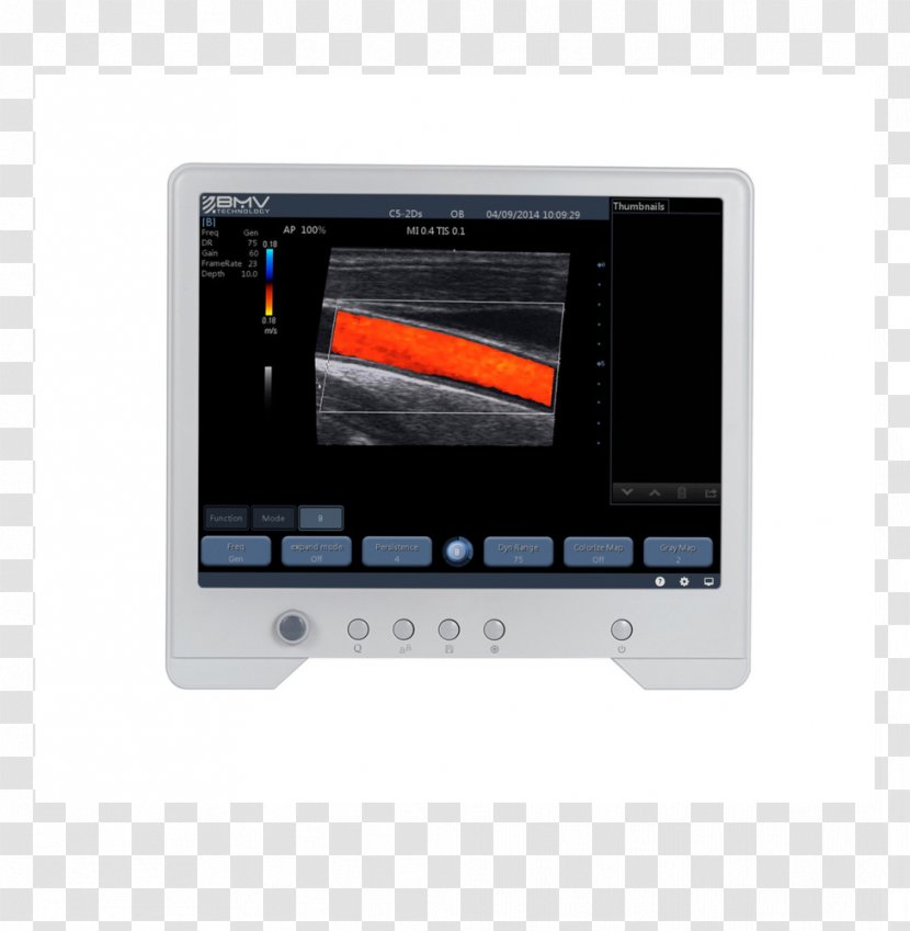 Display Device Ultrasonography Laptop Computer Monitors Ultrasound Transparent PNG