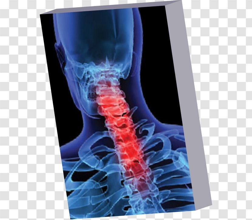 Template Vertebral Column Cervical Vertebrae Anatomy Microsoft PowerPoint - Spinal Cord - Neck Transparent PNG