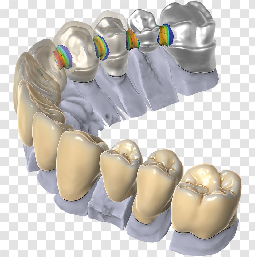 CAD/CAM Dentistry Computer-aided Design Dental Restoration Computer Software - Computeraided - Cadcam Transparent PNG