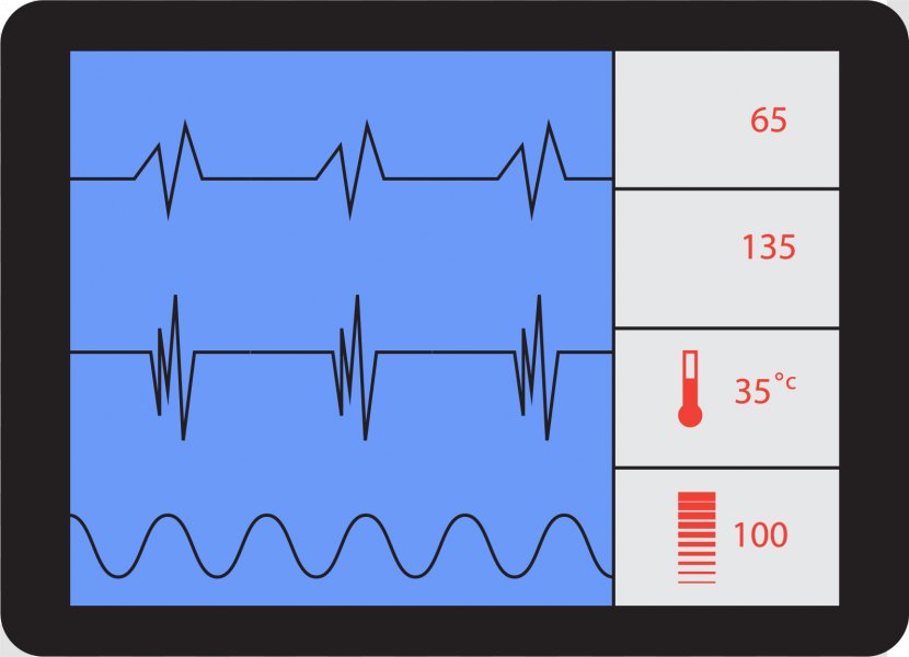 Electrocardiography Heart Rate Icon - Cartoon - ECG Monitor Transparent PNG